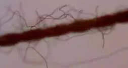 کیفیت نخ مورد استفاده